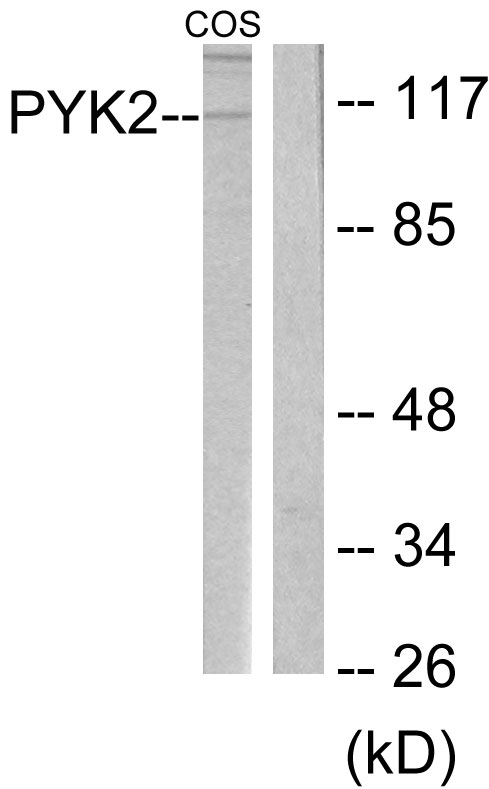 PTK2B / PYK2 Antibody - Western blot analysis of lysates from COS cells, treated with UV 15', using PYK2 Antibody. The lane on the right is blocked with the synthesized peptide.
