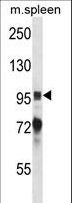 PTK2B / PYK2 Antibody - Mouse Ptk2b Antibody western blot of mouse spleen tissue lysates (35 ug/lane). The Ptk2b antibody detected the Ptk2b protein (arrow).