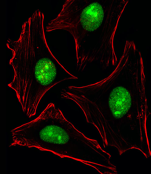 PTK2B / PYK2 Antibody - Fluorescent image of HeLa cells stained with XAF1 PTK2B Antibody. Antibody was diluted at 1:25 dilution. An Alexa Fluor 488-conjugated goat anti-rabbit lgG at 1:400 dilution was used as the secondary antibody (green). Cytoplasmic actin was counterstained with Alexa Fluor 555 conjugated with Phalloidin (red).