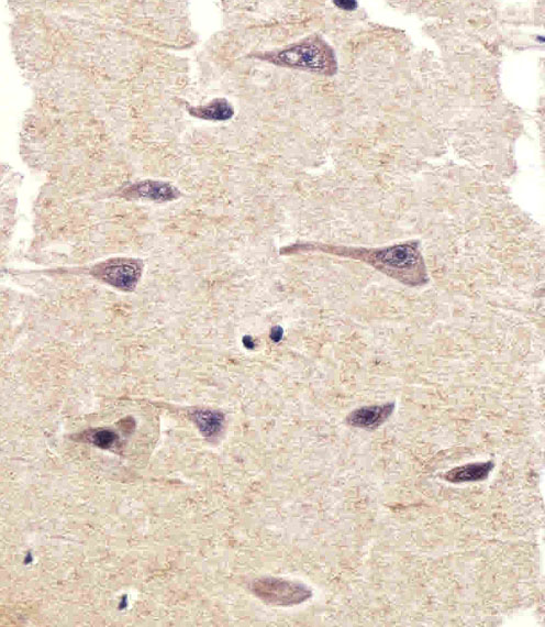 PTK2B / PYK2 Antibody - Immunohistochemical of paraffin-embedded H.brain section using PTK2B Antibody. Antibody was diluted at 1:25 dilution. A peroxidase-conjugated goat anti-rabbit IgG at 1:400 dilution was used as the secondary antibody, followed by DAB staining.