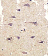 PTK2B / PYK2 Antibody - Immunohistochemical of paraffin-embedded H.brain section using PTK2B Antibody. Antibody was diluted at 1:25 dilution. A peroxidase-conjugated goat anti-rabbit IgG at 1:400 dilution was used as the secondary antibody, followed by DAB staining.