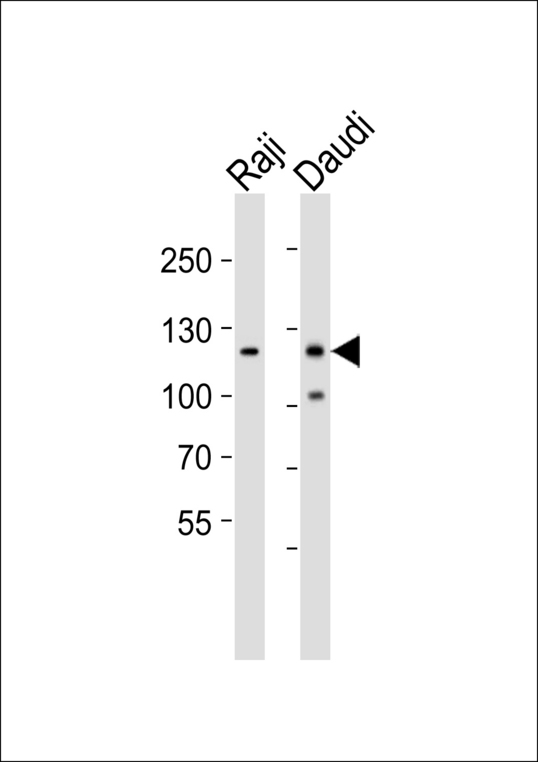 PTK2B / PYK2 Antibody - Western blot of lysates from Raji, Daudi cell line (from left to right) with PTK2B Antibody. Antibody was diluted at 1:1000 at each lane. A goat anti-rabbit IgG H&L (HRP) at 1:5000 dilution was used as the secondary antibody. Lysates at 35 ug per lane.
