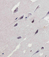 PTK2B / PYK2 Antibody - Immunohistochemical of paraffin-embedded H. brain section using PTK2B Antibody. Antibody was diluted at 1:25 dilution. A peroxidase-conjugated goat anti-rabbit IgG at 1:400 dilution was used as the secondary antibody, followed by DAB staining.