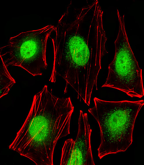 PTK2B / PYK2 Antibody - Fluorescent image of A549 cells stained with PTK2B Antibody. Antibody was diluted at 1:25 dilution. An Alexa Fluor 488-conjugated goat anti-rabbit lgG at 1:400 dilution was used as the secondary antibody (green). Cytoplasmic actin was counterstained with Alexa Fluor 555 conjugated with Phalloidin (red).