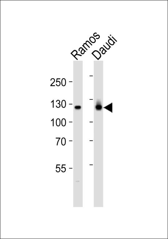 PTK2B / PYK2 Antibody - Western blot of lysates from Ramos, Daudi cell line (from left to right) with PTK2B Antibody. Antibody was diluted at 1:1000 at each lane. A goat anti-rabbit IgG H&L (HRP) at 1:5000 dilution was used as the secondary antibody. Lysates at 35 ug per lane.