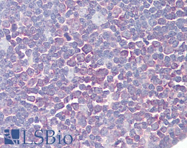 PTK2B / PYK2 Antibody - Anti-PTK2B antibody IHC of human thymus. Immunohistochemistry of formalin-fixed, paraffin-embedded tissue after heat-induced antigen retrieval. Antibody dilution 2.5-5 ug/ml. This image was taken for the unconjugated form of this product. Other forms have not been tested.