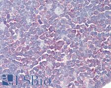 PTK2B / PYK2 Antibody - Anti-PTK2B antibody IHC of human thymus. Immunohistochemistry of formalin-fixed, paraffin-embedded tissue after heat-induced antigen retrieval. Antibody dilution 2.5-5 ug/ml. This image was taken for the unconjugated form of this product. Other forms have not been tested.