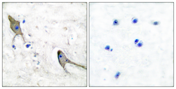 PTK2B / PYK2 Antibody - Immunohistochemistry analysis of paraffin-embedded human brain tissue, using PYK2 Antibody. The picture on the right is blocked with the synthesized peptide.