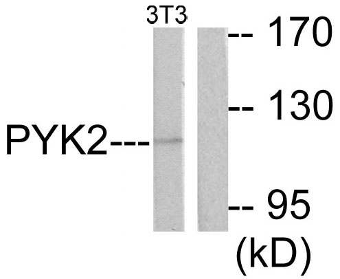 PTK2B / PYK2 Antibody - Western blot analysis of lysates from NIH/3T3 cells, treated with Serum 20% 30', using PYK2 Antibody. The lane on the right is blocked with the synthesized peptide.