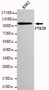 PTK2B / PYK2 Antibody - Western blot detection of PTK2B in K562 cell lysates using PTK2B antibody (1:1000 diluted). Predicted band size:116KDa Observed band size:116KDa.