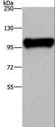PTK2B / PYK2 Antibody - Western blot analysis of Raji cell, using PTK2B Polyclonal Antibody at dilution of 1:300.