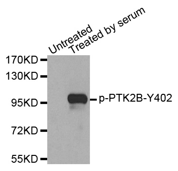 PTK2B / PYK2 Antibody - Western blot analysis of extracts from 293 cells.