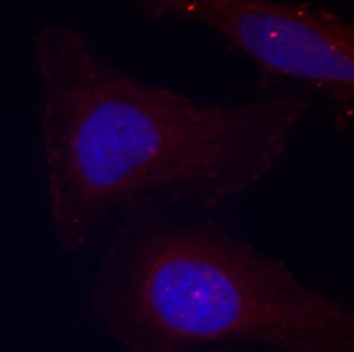 PTK2B / PYK2 Antibody - Immunofluorescence staining of methanol-fixed Hela cells.