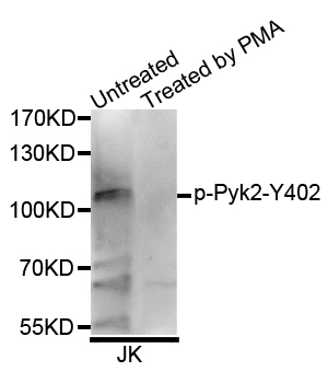 PTK2B / PYK2 Antibody - Western blot analysis of extracts of Jurkat cells.