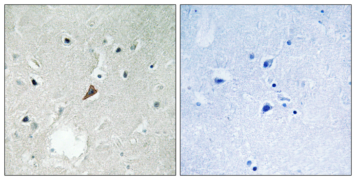 PTK2B / PYK2 Antibody - Immunohistochemistry analysis of paraffin-embedded human brain, using PYK2 (Phospho-Tyr579) Antibody. The picture on the right is blocked with the phospho peptide.