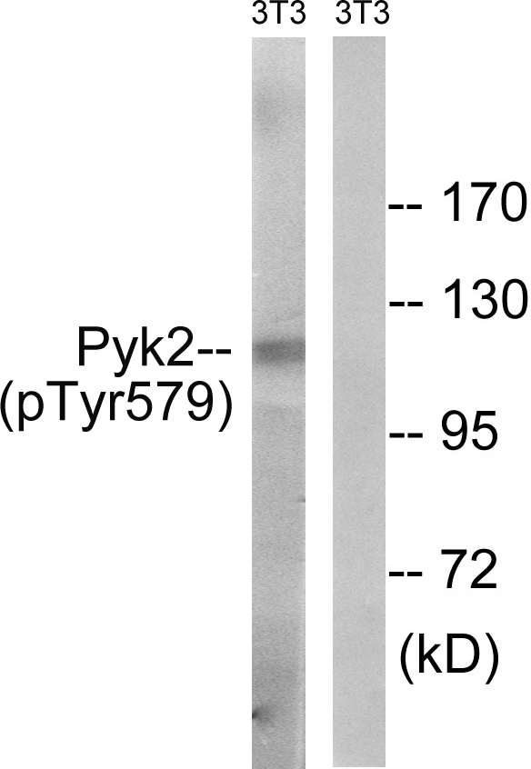 PTK2B / PYK2 Antibody - Western blot analysis of lysates from NIH/3T3 cells, using PYK2 (Phospho-Tyr579) Antibody. The lane on the right is blocked with the phospho peptide.
