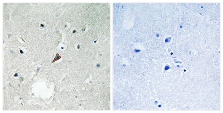 PTK2B / PYK2 Antibody - P-peptide - + Immunohistochemistry analysis of paraffin-embedded human brain tissue using PYK2 (Phospho-Tyr579) antibody.