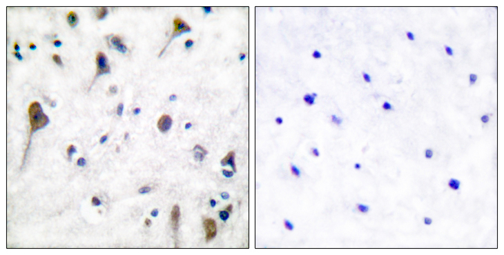 PTK2B / PYK2 Antibody - Immunohistochemistry analysis of paraffin-embedded human brain, using PYK2 (Phospho-Tyr580) Antibody. The picture on the right is blocked with the phospho peptide.
