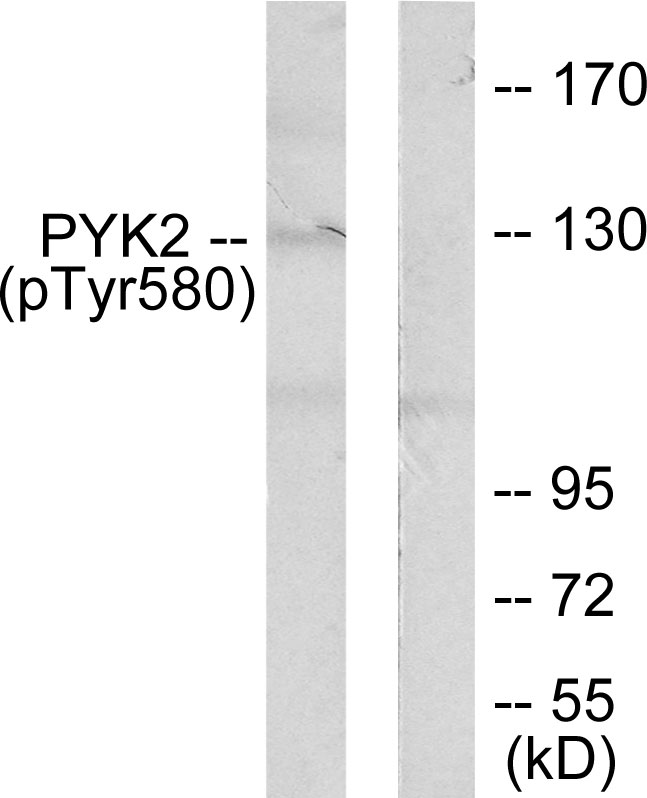 PTK2B / PYK2 Antibody - Western blot analysis of lysates from K562 cells, using PYK2 (Phospho-Tyr580) Antibody. The lane on the right is blocked with the phospho peptide.