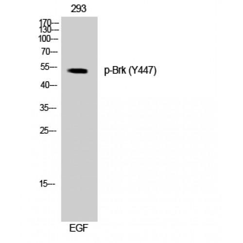 PTK6 / BRK Antibody - Western blot of Phospho-Brk (Y447) antibody