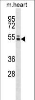 PTK6 / BRK Antibody - Mouse Ptk6 Antibody western blot of mouse heart tissue lysates (35 ug/lane). The Ptk6 antibody detected the Ptk6 protein (arrow).
