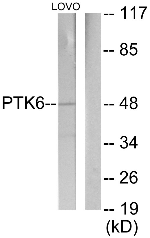 PTK6 / BRK Antibody - Western blot analysis of lysates from LOVO cells, using Breast Tumor Kinase Antibody. The lane on the right is blocked with the synthesized peptide.