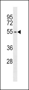 PTK6 / BRK Antibody - Western blot of anti-hPTK6-E26 antibody in A375 cell line lysate (35 ug/lane). hPTK6-E26(arrow) was detected using the purified antibody.