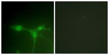 PTK6 / BRK Antibody - Immunofluorescence analysis of NIH/3T3 cells, using Breast Tumor Kinase Antibody. The picture on the right is blocked with the synthesized peptide.