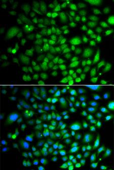 PTK6 / BRK Antibody - Immunofluorescence analysis of A549 cells.