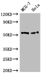 PTK6 / BRK Antibody - Positive WB detected in:MCF-7 whole cell lysate,Hela whole cell lysate;All lanes:PTK6 antibody at 2.4?g/ml;Secondary;Goat polyclonal to rabbit IgG at 1/50000 dilution;Predicted band size: 52,15 KDa;Observed band size: 52 KDa;