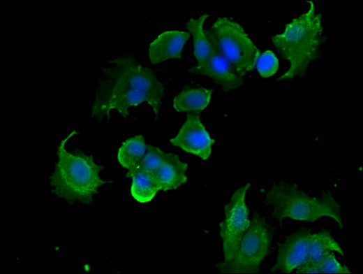 PTK6 / BRK Antibody - Immunofluorescent analysis of MCF-7 cells using PTK6 Antibody at a dilution of 1:100 and Alexa Fluor 488-congugated AffiniPure Goat Anti-Rabbit IgG(H+L)