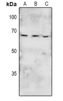 PTK6 / BRK Antibody - Western blot analysis of BRK (pY447) expression in HEK293T (A), rat kidney (B), rat lung (C) whole cell lysates.