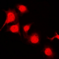 PTK6 / BRK Antibody - Immunofluorescent analysis of BRK (pY447) staining in NIH3T3 cells. Formalin-fixed cells were permeabilized with 0.1% Triton X-100 in TBS for 5-10 minutes and blocked with 3% BSA-PBS for 30 minutes at room temperature. Cells were probed with the primary antibody in 3% BSA-PBS and incubated overnight at 4 °C in a hidified chamber. Cells were washed with PBST and incubated with Alexa Fluor 647-conjugated secondary antibody (red) in PBS at room temperature in the dark.