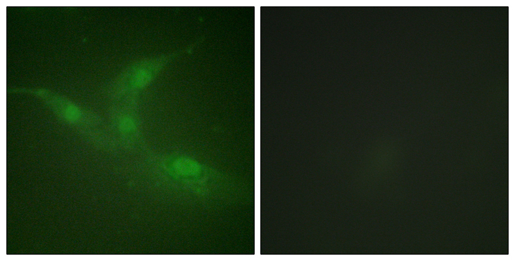 PTK6 / BRK Antibody - Immunofluorescence analysis of NIH/3T3 cells, using Breast Tumor Kinase (Phospho-Tyr447) Antibody. The picture on the right is blocked with the phospho peptide.