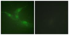 PTK6 / BRK Antibody - Immunofluorescence analysis of NIH/3T3 cells, using Breast Tumor Kinase (Phospho-Tyr447) Antibody. The picture on the right is blocked with the phospho peptide.