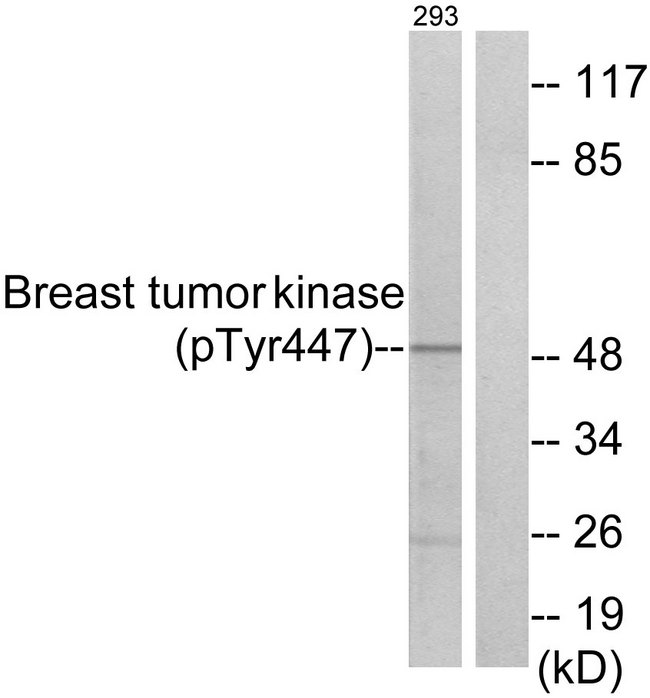 PTK6 / BRK Antibody - Western blot analysis of lysates from 293 cells treated with EGF 200ng/ml 30', using Breast Tumor Kinase (Phospho-Tyr447) Antibody. The lane on the right is blocked with the phospho peptide.