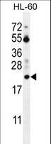 PTMA / Prothymosin Alpha Antibody - PTMA Antibody western blot of HL-60 cell line lysates (35 ug/lane). The PTMA antibody detected the PTMA protein (arrow).