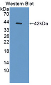 PTMA / Prothymosin Alpha Antibody - Western blot of PTMA / Prothymosin Alplha antibody.