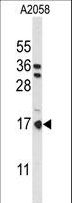 PTMS / Parathymosin Antibody - Western blot of PTMS Antibody in A2058 cell line lysates (35 ug/lane). PTMS (arrow) was detected using the purified antibody.