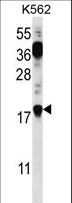 PTMS / Parathymosin Antibody - PTMS Antibody western blot of K562 cell line lysates (35 ug/lane). The PTMS antibody detected the PTMS protein (arrow).