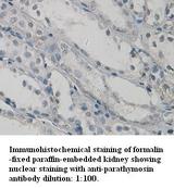PTMS / Parathymosin Antibody