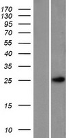 PTMS / Parathymosin Protein - Western validation with an anti-DDK antibody * L: Control HEK293 lysate R: Over-expression lysate
