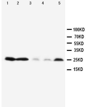 PTN / Pleiotrophin Antibody - WB of PTN / Pleiotrophin antibody. Lane 1: Rat Brain Tissue Lysate. Lane 2: Rat Kidney Tissue Lysate. Lane 3: MCF-7 Cell Lysate. Lane 4: HT-1080 Cell Lysate. Lane 5: SMMC Cell Lysate.