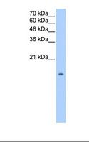 PTN / Pleiotrophin Antibody - Jurkat cell lysate. Antibody concentration: 0.5 ug/ml. Gel concentration: 15%.  This image was taken for the unconjugated form of this product. Other forms have not been tested.