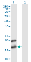 PTN / Pleiotrophin Antibody - Western blot of PTN expression in transfected 293T cell line by PTN monoclonal antibody (M02), clone 2E3.