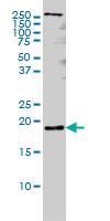 PTN / Pleiotrophin Antibody - PTN monoclonal antibody (M01), clone 5C3 Western blot of PTN expression in HeLa NE.