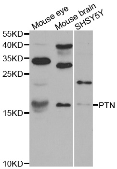 PTN / Pleiotrophin Antibody - Western blot analysis of extracts of various cell lines, using PTN antibody.