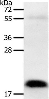 PTN / Pleiotrophin Antibody - Western blot analysis of Human colon cancer tissue, using PTN Polyclonal Antibody at dilution of 1:600.