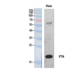 PTN / Pleiotrophin Antibody - Western Blot analysis of extracts from HeLa cells using PTN Antibody.