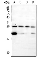 PTN / Pleiotrophin Antibody - Western blot analysis of Pleiotrophin expression in Hela (A), BV2 (B), C6 (C), U87MG (D) whole cell lysates.